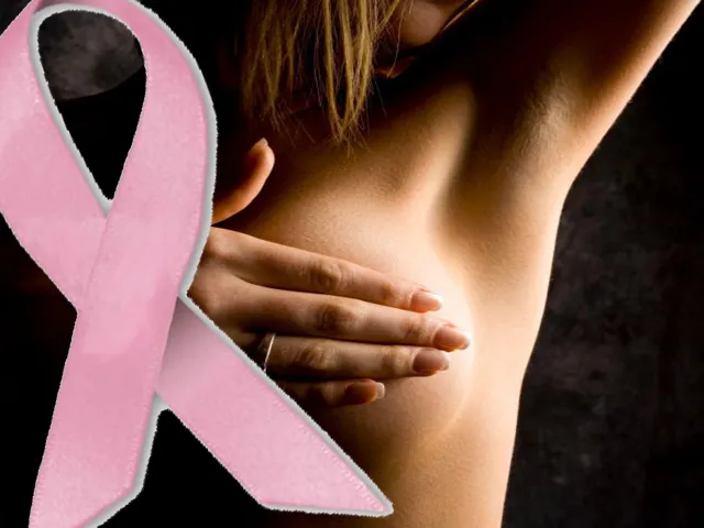 cancer de mama
